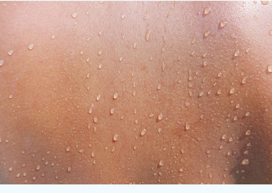 Is cellulitis hereditary?