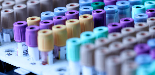 Wegener's disease (granulomatosis with polyangiitis)