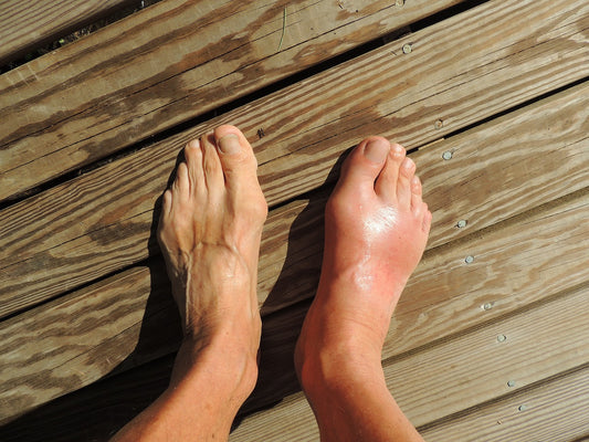 Gout: An Old Disease in New Light
